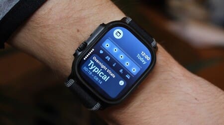 How the Apple Watch Vitals app works—and four tips to get more out of it apple-watch-vitals