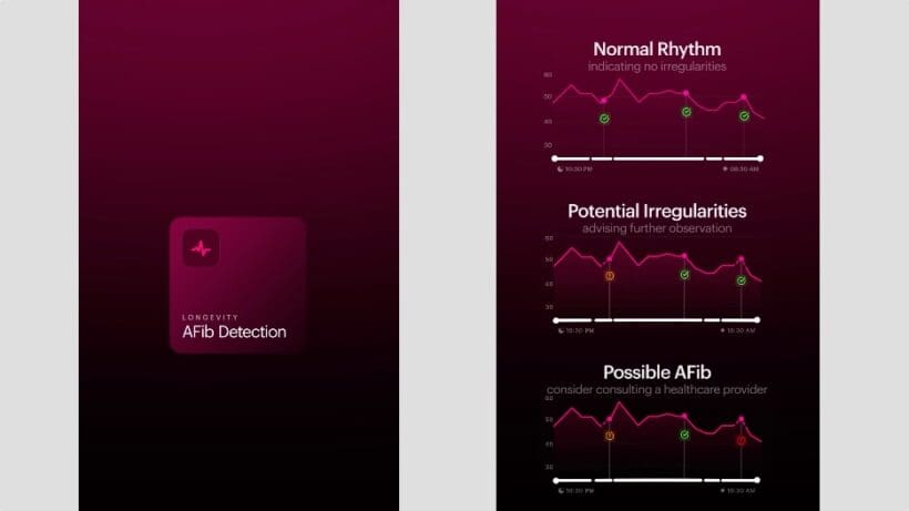 Ultrahuman Afib