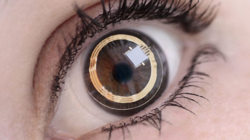 Triggerfish smart contact lens all set to tackle glaucoma