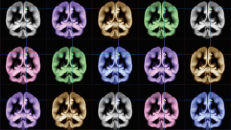 An Oculus exec wants to build affordable, wearable MRI machines