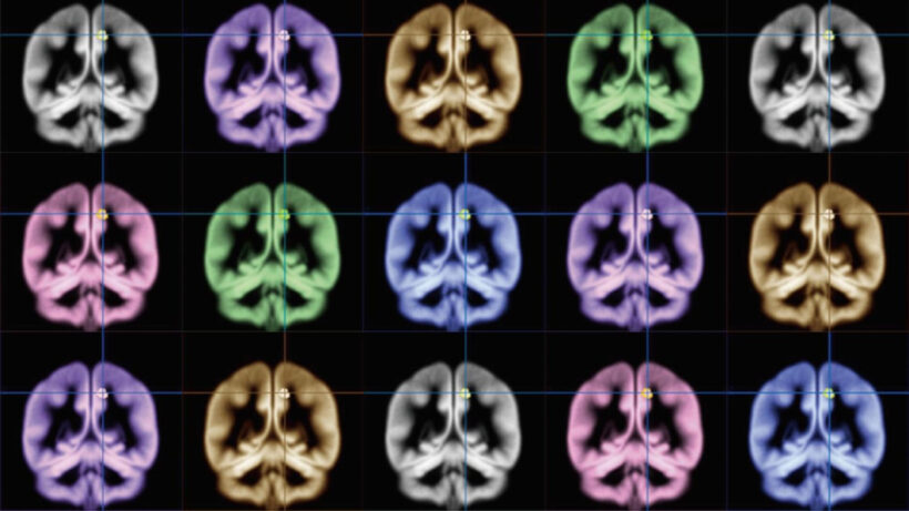 An Oculus exec wants to build affordable, wearable MRI machines