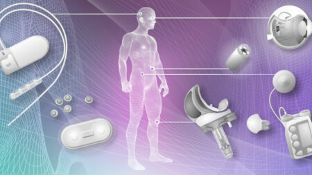 Implantables: Would you go that far? Implantables: Would you go that far?