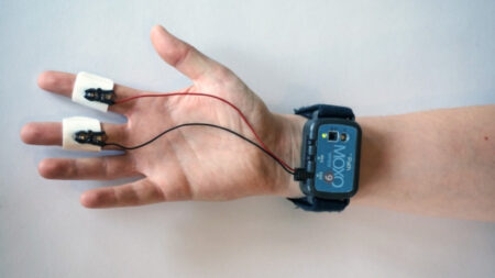 This Moxo wearable can measure how you’re feeling This Moxo wearable can measure how you're feeling