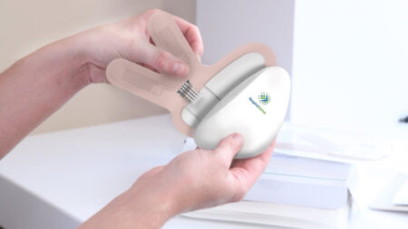 RespiraSense receives NHS Innovation Accelerator backing RespiraSense receives NHS Innovation Accelerator backing