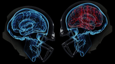 Both on and off the field, wearables are taking on the NFL’s concussion crisis Both on and off the field, wearables are taking on the NFL's concussion crisis