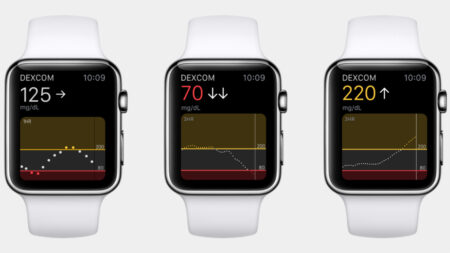 Apple Watch vs diabetes: The glucose monitoring story so far Apple Watch vs diabetes: The glucose monitoring story so far