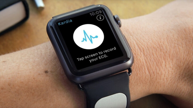 Apple Watch and KardiaBand: Inside AliveCor’s massive hyperkalemia study