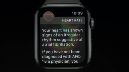 And finally: Apple Watch Series 4 detects AFib with 98% accuracy, says Heart Study And finally: Apple Watch Series 4 detects AFib with 98% accuracy, says Heart Study