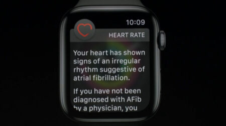 Apple Watch Series 4 ECG feature could take years to be approved in the UK Apple Watch Series 4 ECG feature could take years to be approved in the UK