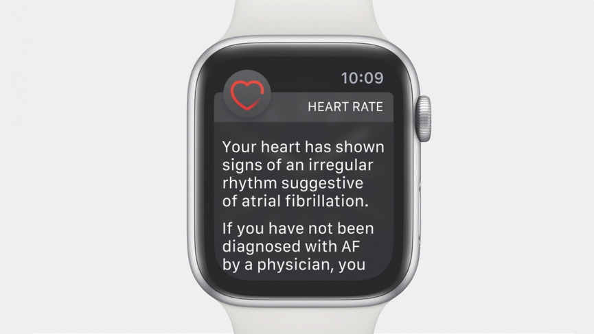 Fitbit launches massive Afib study and confirms ECG is on the way