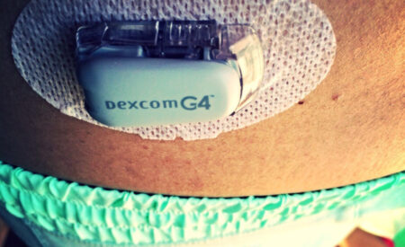 Google on board for next-gen glucose monitoring for diabetics Google on board for next-gen glucose monitoring for diabetics