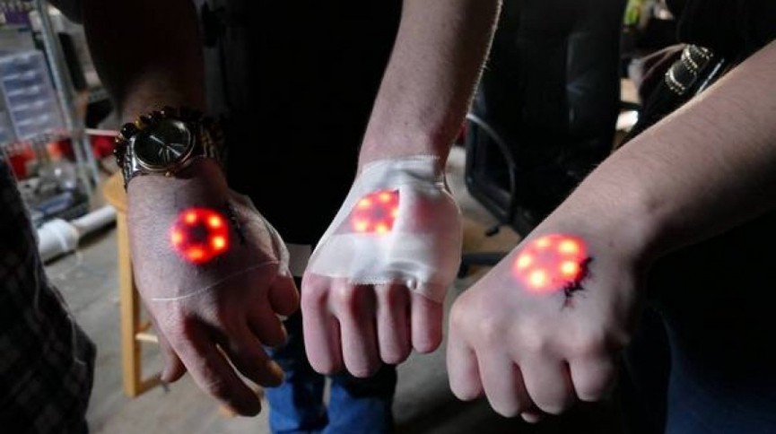 #Trending: Ingestibles and implantables are here
