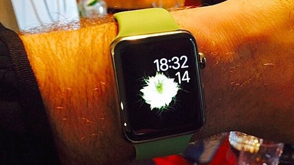 These celebrities are wearing the Apple Watch you won't be able to afford