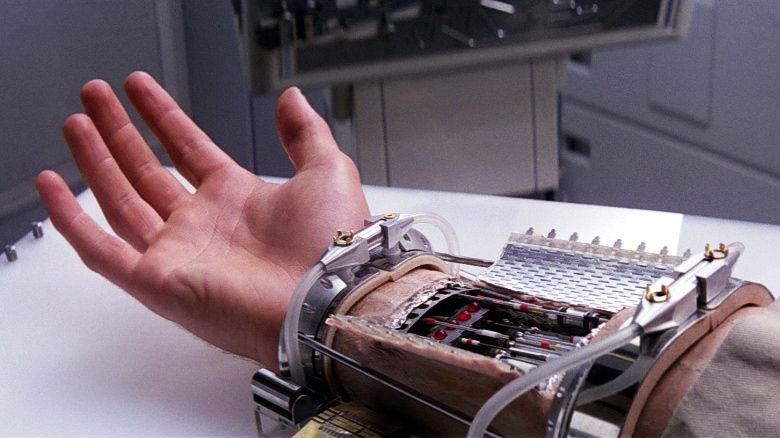Beyond sci-fi: Building the bionic body