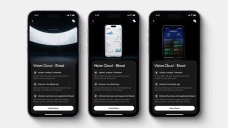 Ultrahuman expands Blood Vision service with a free analysis tool and a new $99 test vision-cloud-ultrahuman