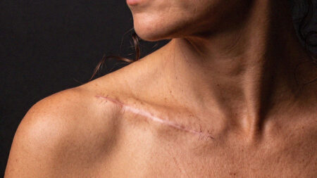 Best red light therapy devices for scars in 2026: Top picks tested